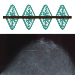 Precision Dynamics Mammography Scar Marker Spee-D-Line™ Swirl Collection™ 1.0 mm Line - M-1094943-4003 - Box of 120