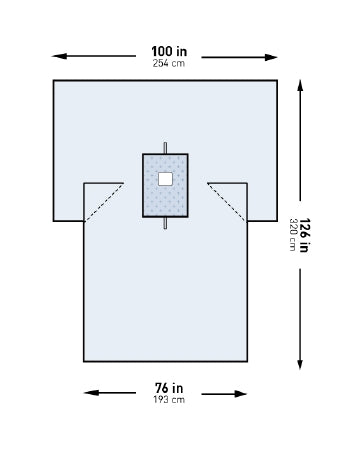 Surgical Drape McKesson Breast Drape 100 W X 76 W X 126 L Inch Sterile