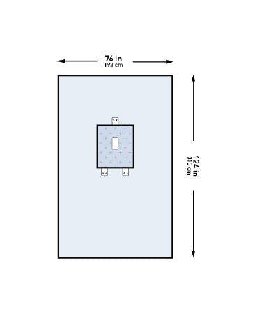 Abdominal Drape McKesson Pediatric Laparotomy Drape 76 W X 124 L Inch Sterile