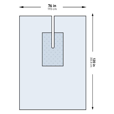 Orthopedic Drape McKesson U-Drape with Split 76 W X 120 L Inch Sterile