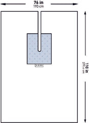Orthopedic Drape McKesson U-Drape with Split 76 W X 110 L Inch Sterile