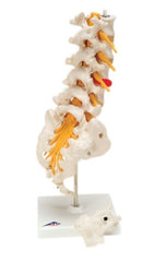 Fabrication Enterprises Anatomical Model 3B® Prolapsed Lumbar Section 3 lbs.