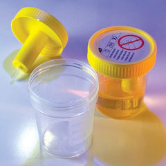 Globe Scientific Urine Specimen Container with Integrated Transfer Device TransferTop™ 120 mL (4 oz.) Screw Cap Sterile