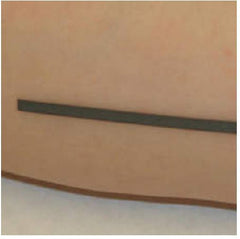 Precision Dynamics MARKER, SKIN INDICATOR RADIOPAQUE 1.5MM (125/BX) - M-1120115-3408 - Box of 125