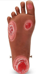  ULCER, FOOT GERI/KERI MED SKIN