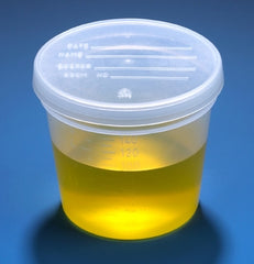 Globe Scientific Specimen Container 2-1/4 X 2-7/8 Inch Polypropylene 150 mL (5 oz.) Snap-On Lid Patient Information NonSterile