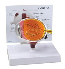 Ward's Science MODEL, EYE GPI ANATOMICALS COMPACT SZ REMOVABLE LENS/CORNEA