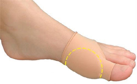 Pedifix BUNION SLEEVE, RELIEF VISCO-GEL COVERED LG/XLG