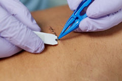 Florida Medical Sales Suture Removal Kit
