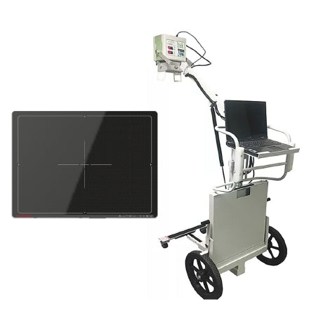 Rayence Inc DPX DR X-Ray System Rayence Portable with Panel 26 X 38-3/4 X 52-3/4 INch 100 lbs. Battery Operated