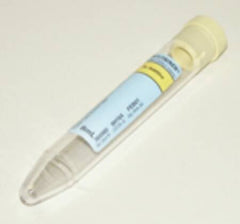 Becton Dickinson BD Vacutainer® Urinalysis Tube Conical Bottom Plain 16 X 100 mm 8 mL Yellow Conventional Closure Plastic Tube