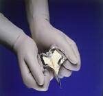 Aspen Surgical Products Surgical Blade Bard-Parker® SafetyLock™ Rib-Back® Carbon Steel No. 12 Sterile Disposable Individually Wrapped - M-213951-1372 - Case of 150