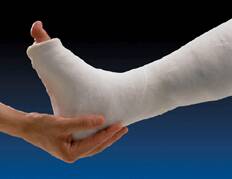 BSN Medical Plaster Bandage Gypsona® HP 6 Inch X 15 Foot Plaster White