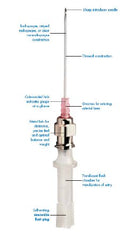 Smiths Medical Peripheral IV Catheter Cathlon® 20 Gauge 1.25 Inch Without Safety - M-148236-1313 - Case of 200