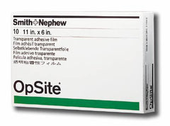 Smith & Nephew Transparent Film Dressing OpSite Rectangle 6 X 11 Inch 2 Tab Delivery Without Label Sterile
