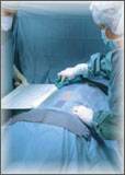 Microtek Medical Orthopedic Drape TMJ Uni-Lateral Drape Body Drape: 77 X 78 Inch, Head Drape: 77 X 55-1/2 Inch