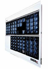 Wolf X-Ray X-Ray Illuminator Trimline Plus 1 Bank 1 Tier 4 Lamp 15 W Wall Mount 3-1/4 X 14 X 22 Inch White One, 14 X 17 Inch Film