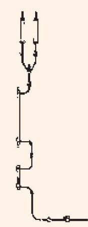 Smiths Medical Trauma Administration Set Level 1® 800 mL / min Drip Rate - M-278458-1778 - Case of 10