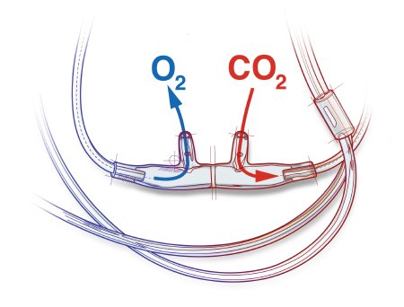 Sun Med ETCO2 Nasal Sampling Cannula with O2 Delivery With Oxygen Delivery Salter-Style® Adult Curved Prong / NonFlared Tip