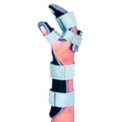 Patterson Medical Supply Resting Hand Orthosis Plastic Left Hand Blue Medium