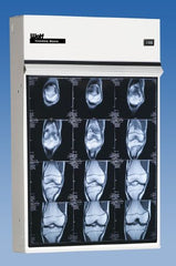 Wolf X-Ray X-Ray Illuminator Trimline Basic 8 Bank 2 Tier 2 Lamp Wall Mount 56 W X 44 H X 3-1/4 D Inch Eight, 17 L X 14 W Inch Film