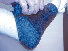 BSN Medical Cast Tape Delta-Lite® Plus 5 Inch X 12 Foot Fiberglass White