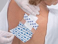 Hartmann Transparent Film Dressing Hydrofilm® Rectangle 2-2/5 X 2-3/4 Inch 4 Tab Delivery Without Label Sterile