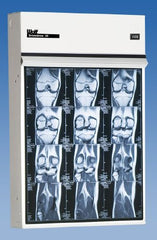 Wolf X-Ray X-Ray Illuminator Trimline III 3 Bank 1 Tier 3 Lamp 15 W Mobile Stand 42 W X 22 H X 3-1/4 D Inch Three, 17 L X 14 W Inch Film