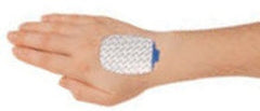 Natus Medical EMG Electrode - M-724518-1994 - Box of 50