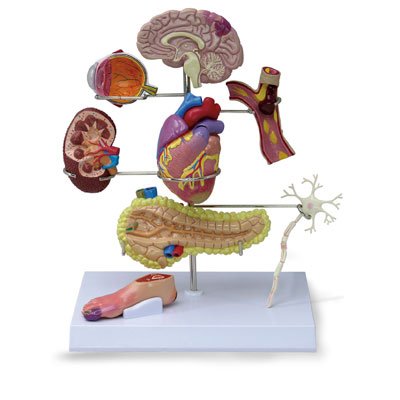 Nasco Type 2 Diabetes Model