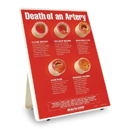 Nasco Death of an Artery Model