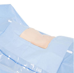 O&M Halyard Inc Abdominal Drape Halyard Basics* Bariatric Drape 118 W X 92 W X 124 L Inch Sterile