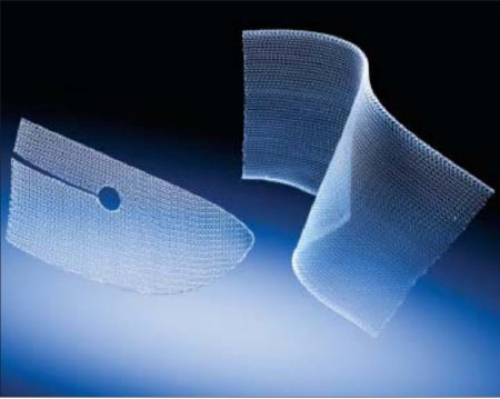 Inguinal Hernia Repair Mesh Bard® Mesh Flat Sheet Nonabsorbable Polypropylene Monofilament 6 X 6 Inch Square Style White Sterile