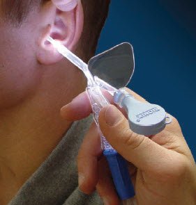 Bionix Vacuum Aspiration Curette Lighted Ear Curette™