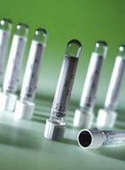 Greiner Bio-One VACUETTE® Z Serum Sep Clot Activator Venous Blood Collection Tube Serum Tube Clot Activator / Separator Gel Additive 13 X 100 mm 5 mL Gold / Black Ring Pull Cap Polyethylene Terephthalate (PET) Tube