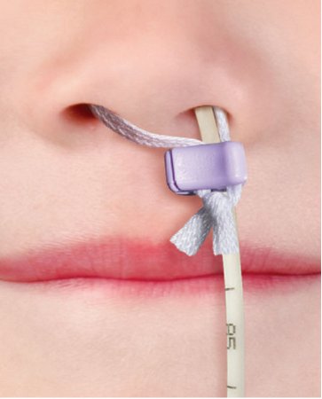 Applied Medical Technologies Spare Clip AMT Micro Bridle™ 18 Fr.