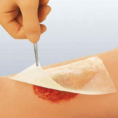 Smith & Nephew Impregnated Dressing Cuticerin 4 X 4 Inch Acetate Gauze Cuticerin Ointment Sterile