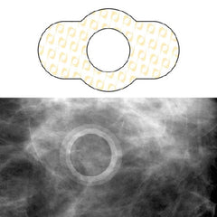 Precision Dynamics Skin Marker Spee-D-Ring™ Yellow / White 0.5 Inch Inside Ø - M-880906-1214 - Box of 100