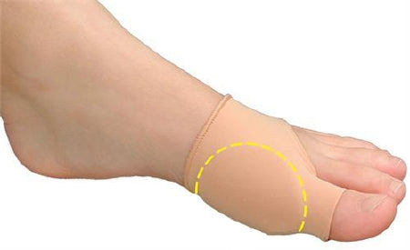 Pedifix Bunion Sleeve Visco-GEL® Bunion Care™ Small / Medium Pull-On Foot