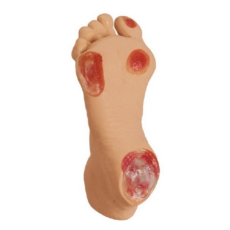 Nasco Pressure Ulcer Foot Model Life/Form® Adult - Geriatric 2-1/5 lbs.