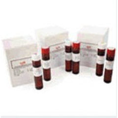 Sekisui Diagnostics Reagent Kit K-ASSAY® Immunochemistry / Specific Protein Test Immunoglobulin M (IgM) For Chemistry Analyzers Capable of Accurate Readings at 700 nm 285 Tests R1: 4 X 20 mL, R2: 2 X 10 mL