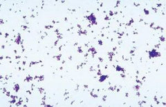 Ward's Science TUBE CULTURE C. XEROSIS 16X125MM D/S