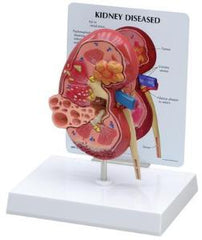 Ward's Science Kidney Model GPI Anatomicals
