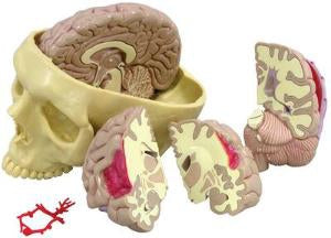 Ward's Science Brain in Skull Pathologies Model GPI Anatomicals