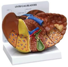Ward's Science Liver Pathology Model GPI Anaotomicals