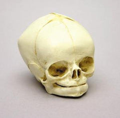 Ward's Science Fetal Skull Model Bone Clones