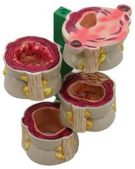 Ward's Science Colon Model GPI Anatomicals