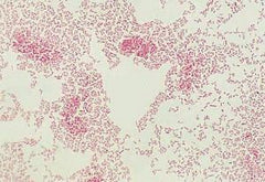 Ward's Science TUBE CULTURE E.COLI 16X125MM W/MEDIA D/S