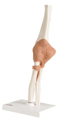 Fabrication Enterprises Functional Elbow Joint Model 13 lbs.