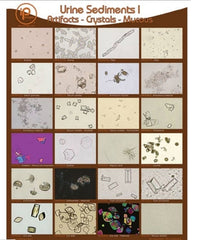 Market Lab Inc Poster and Binder Cards Urine Sediments 19 X 24 Inch